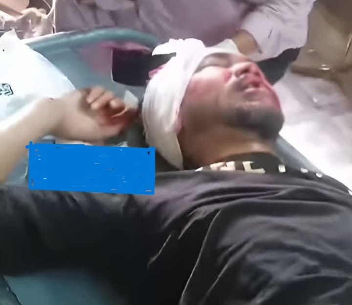 শার্শায় দুই মোটরসাইকেলের সংঘর্ষে আহত ৫