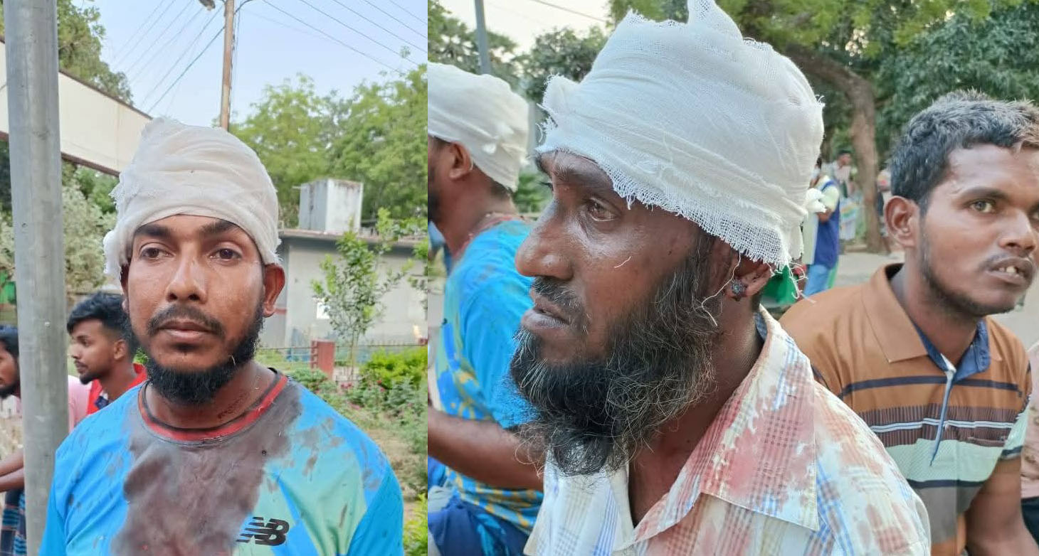 তানোরে প্রতিবন্ধীকে পাগল বলাকে কেন্দ্র করে দেশীয় অস্ত্র নিয়ে হামলা মারপিট: আহত ৪