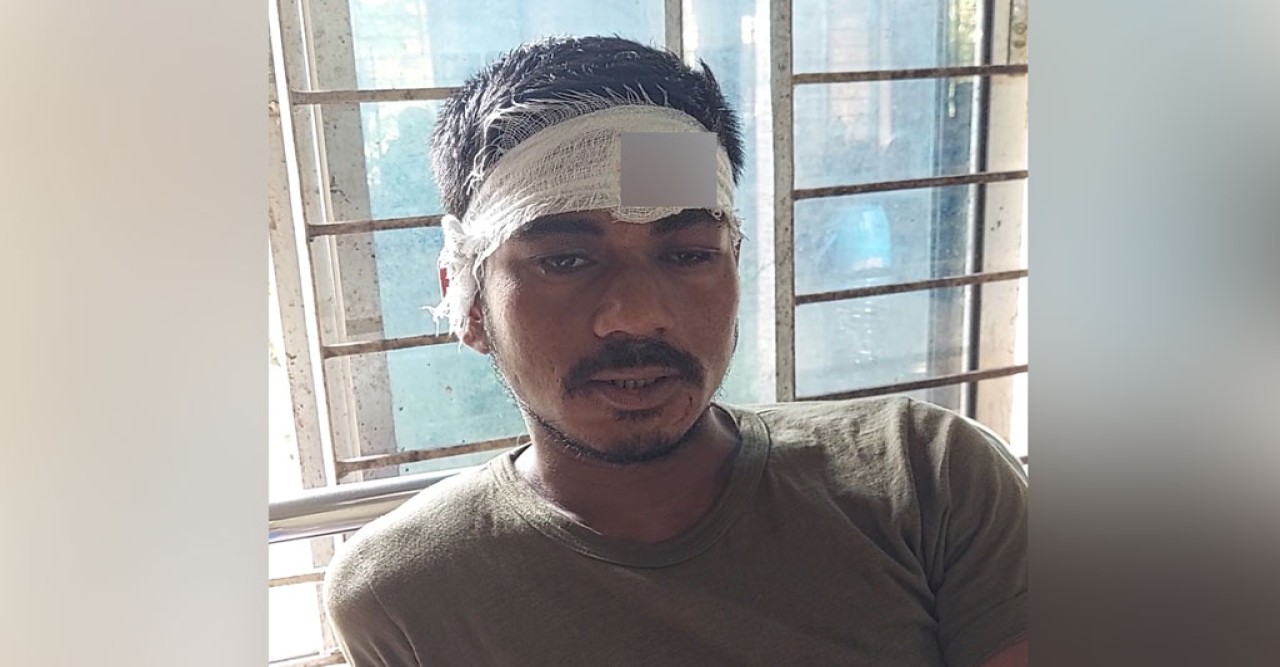 সিগারেটের মূল্যবৃদ্ধি নিয়ে বাগ্‌বিতণ্ডা: ক্রেতার মাথা ফাটালেন মুদি ব্যবসায়ী